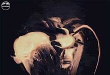 BOMBS OF HADES: Phantom Bell